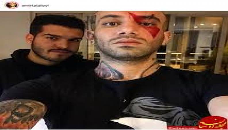 آهنگ جهنم از تتلو