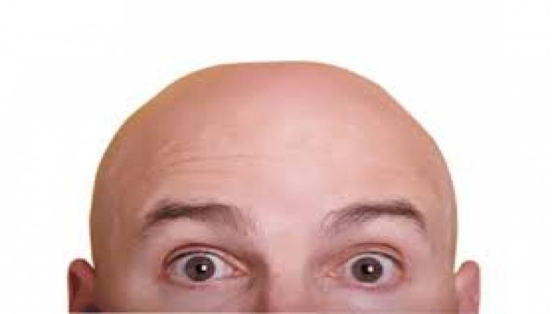 درمان عجیب کچلی