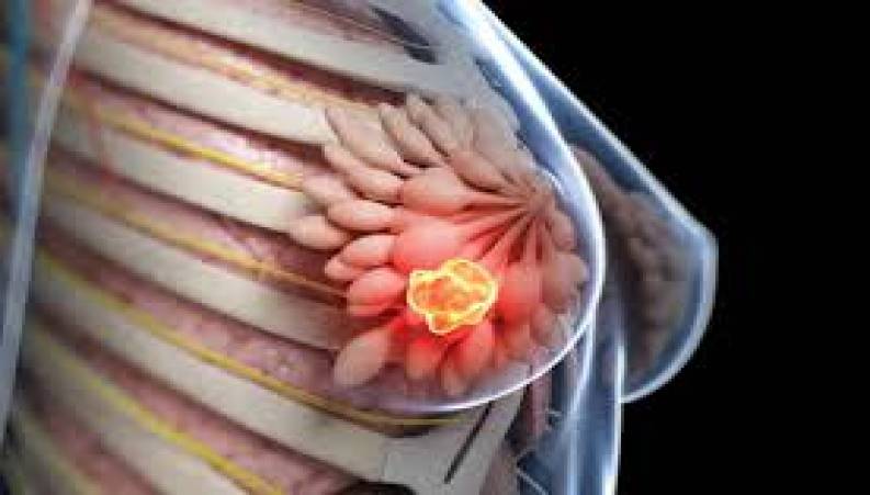 پیشگیری از سرطان سینه با سحرخیزی