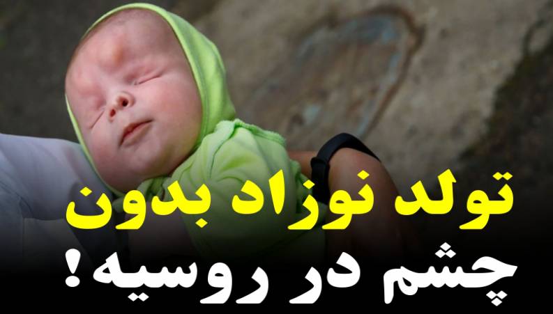 تولد نوزاد زیبا بدون چشم که در خیابان رها شده بود