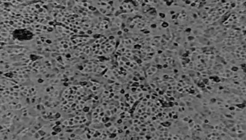 اولین فیلم از ویروس کرونا در بدن یک بیمار در زیر میکروسکوپ 