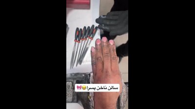 این ویدئو از روند کاشت و ترمیم ناخن پسرها تو کمتر از یک روز، ۵ میلیون ویو خورده