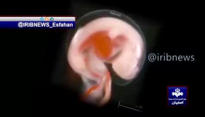 جنین فریز شده پس از ۱۲ سال در اصفهان زنده شد