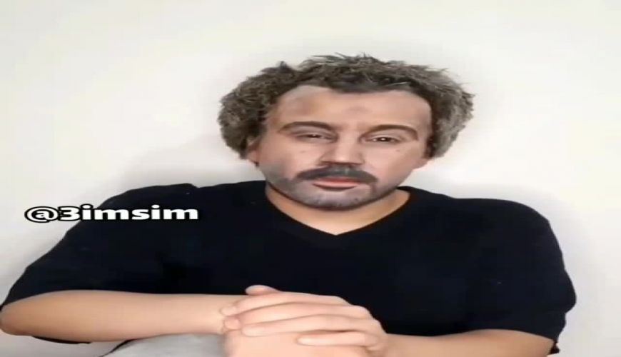 گریم نقی معمولی  محسن تنابنده روی صورت یک دختر