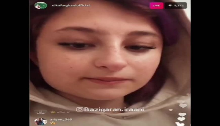 لایو نیکا فرقانی بازیگر پایتخت در مورد جراحی زیبایی صورتش