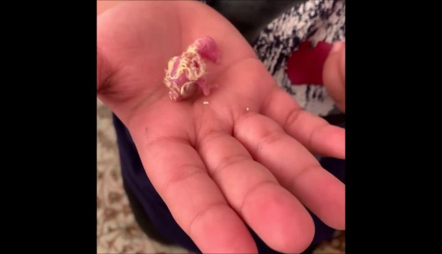 عروس هلندی بند انگشتی تازه متولد شده در دستان یک نوجوان
