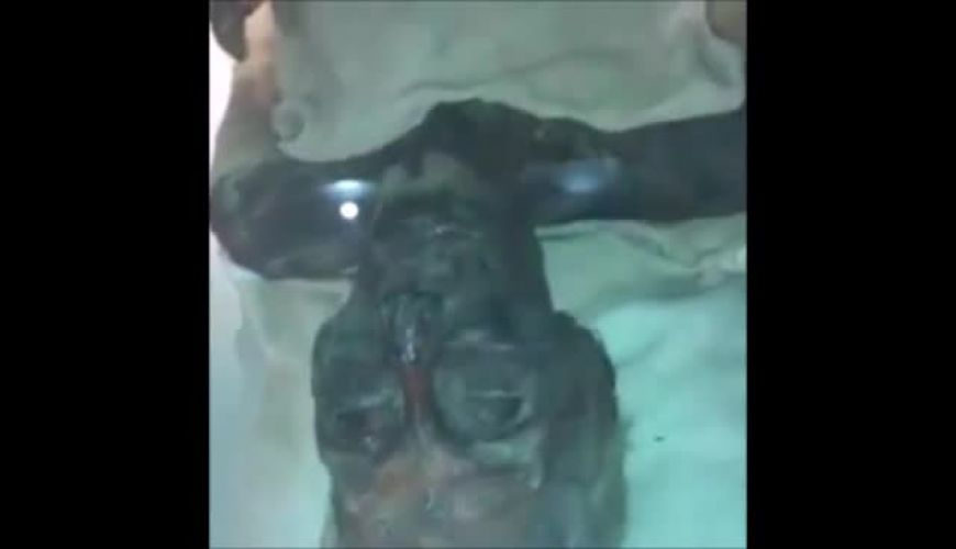  جسد مومیایی شده رامسس دوم  ، فرعون تاریخ مصر  بعد از گذشت سه هزار سال!