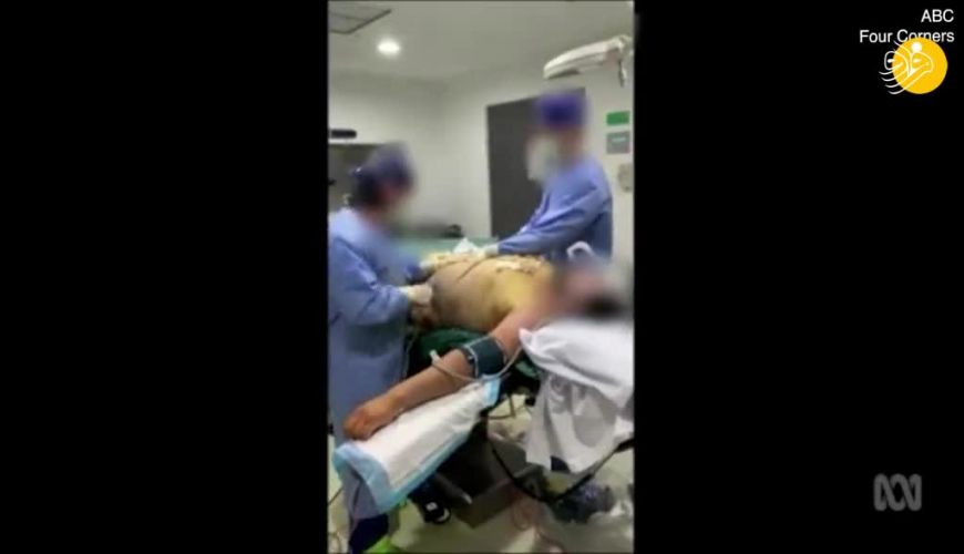 جنجالی شدن عمل لیپوساکشن روی بیمار همراه با رقص و خنده جراحان 