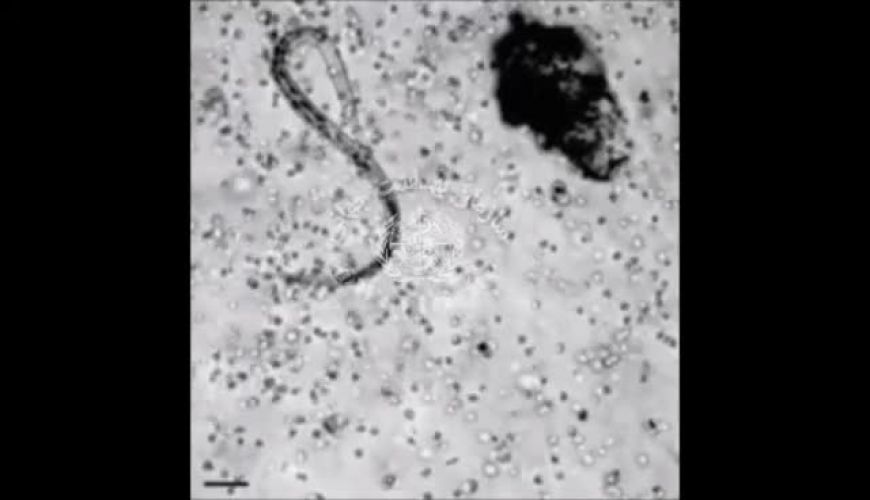 فیلمی زیبا از نحوه مبارزه ی  گلبول های سفید خون و انگل ها