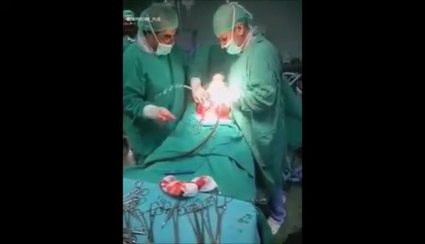 لحظه هیجانی  به دنیا آمدن چند قلو ها با سزارین ، حسابشون از دست دکتر در رفت !!