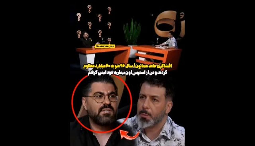 افشاگری جالب حامد همایون، سر این موضوع دچار بیماری خود ایمنی شدم
