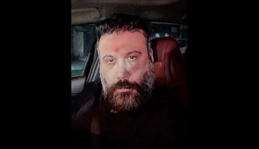 چهره شکسته محسن چاوشی در عکس جدیدش جلب‌توجه کرد